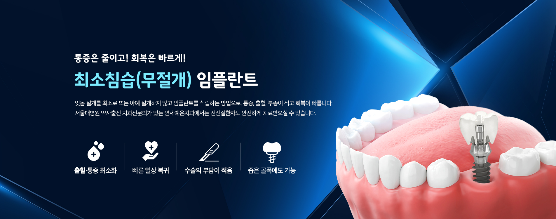 최소침습(무절개) 임플란트