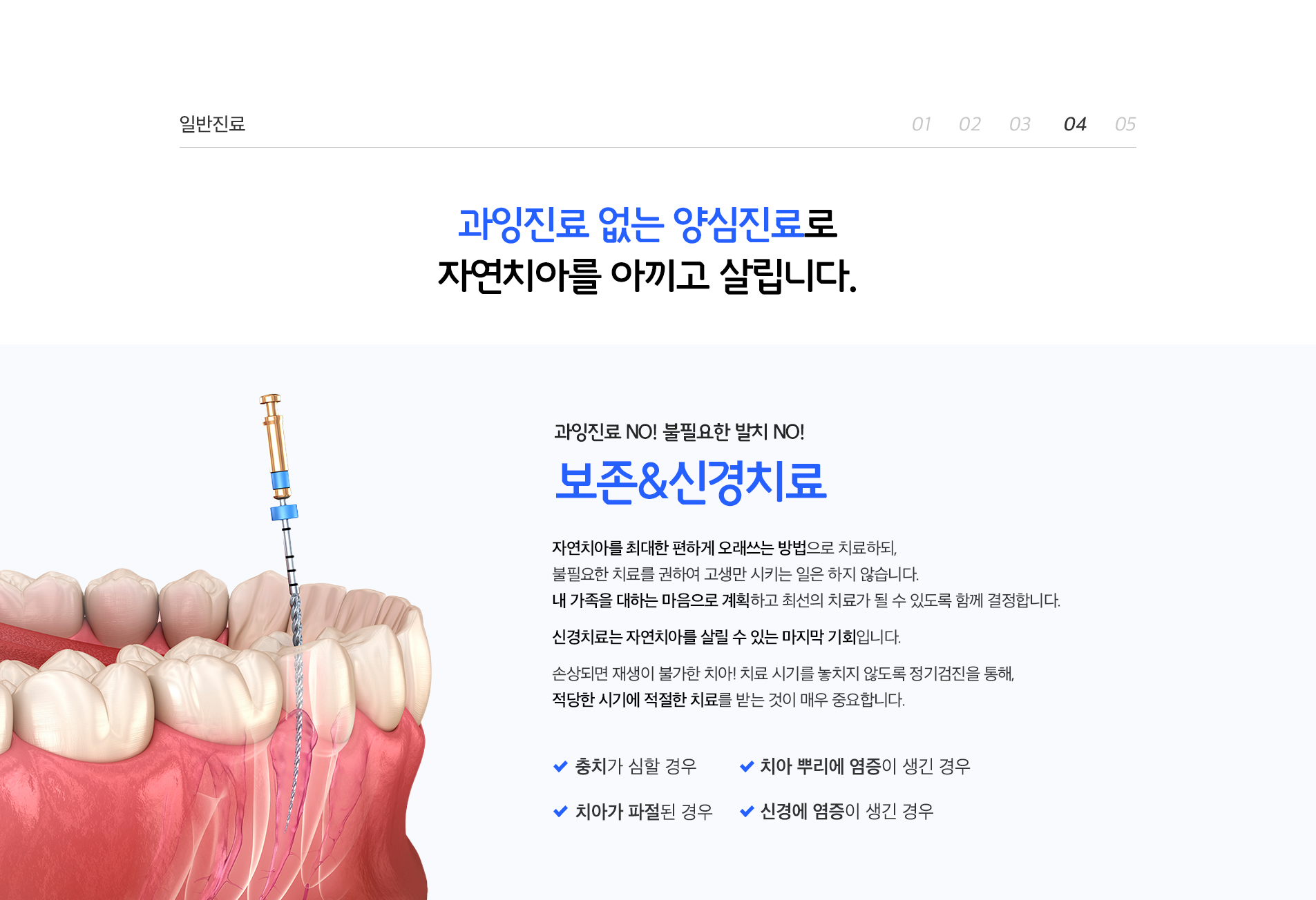 과잉진료 없는 양심진료로 자연치아를 아끼고 살립니다.