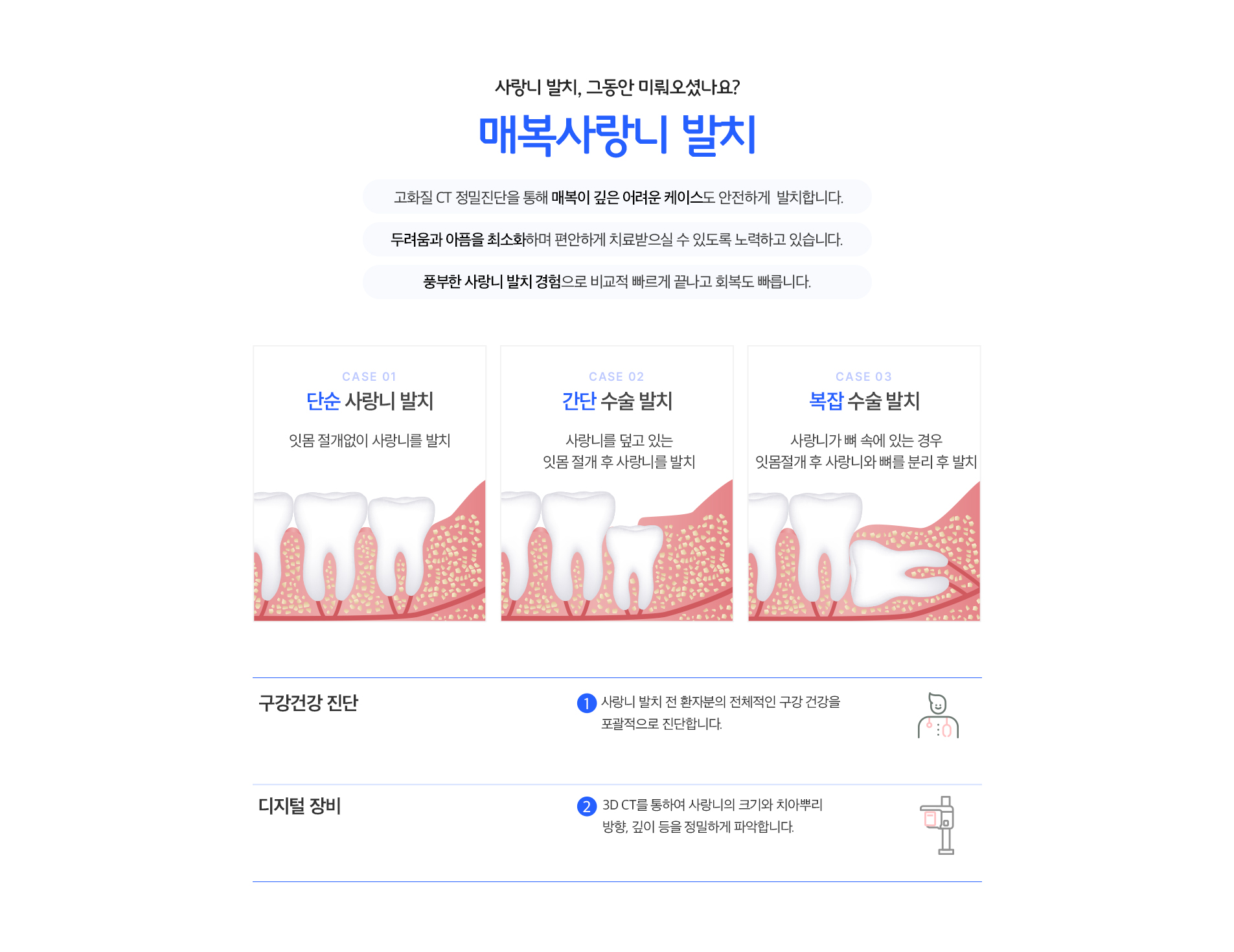 매복사랑니 발치