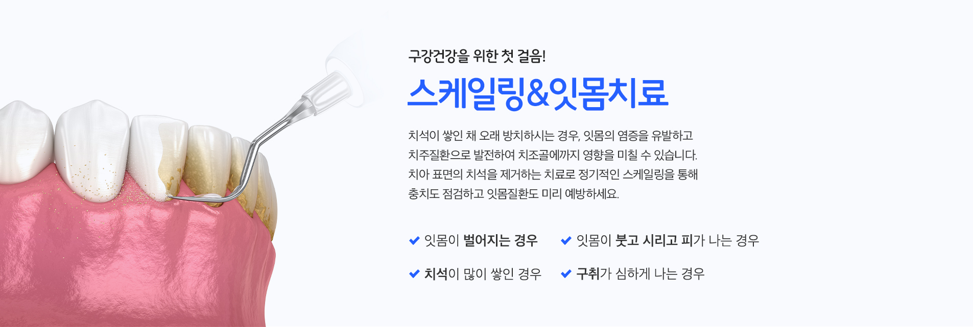 스케일링&잇몸치료