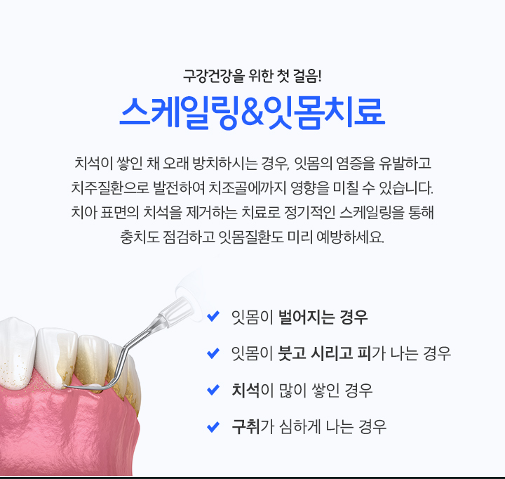 스케일링&잇몸치료